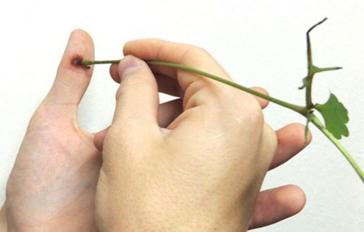 quitar una verruga en un dedo con jugo de hierba celidonia