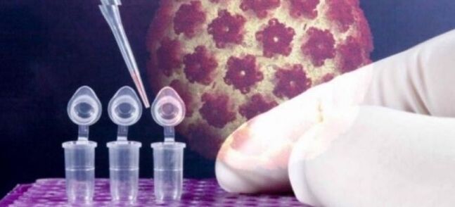 Diagnóstico del VPH mediante la prueba digene